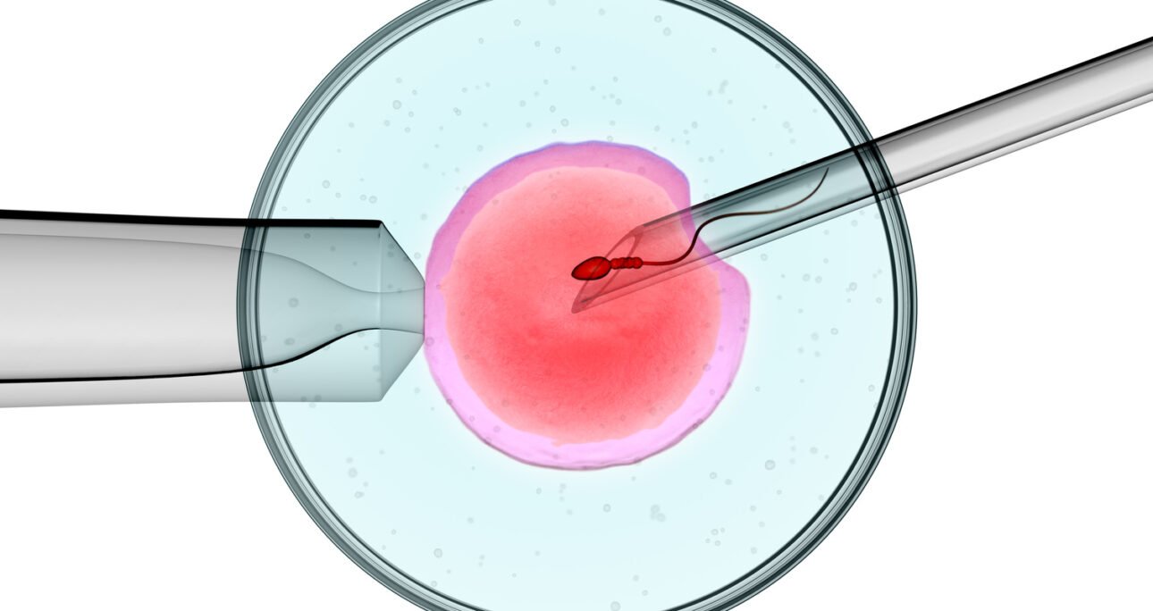 What is Intracytoplasmic Sperm Injection (ICSI)?