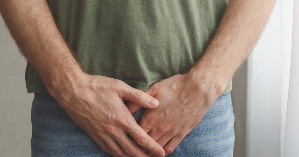 What are varicoceles?