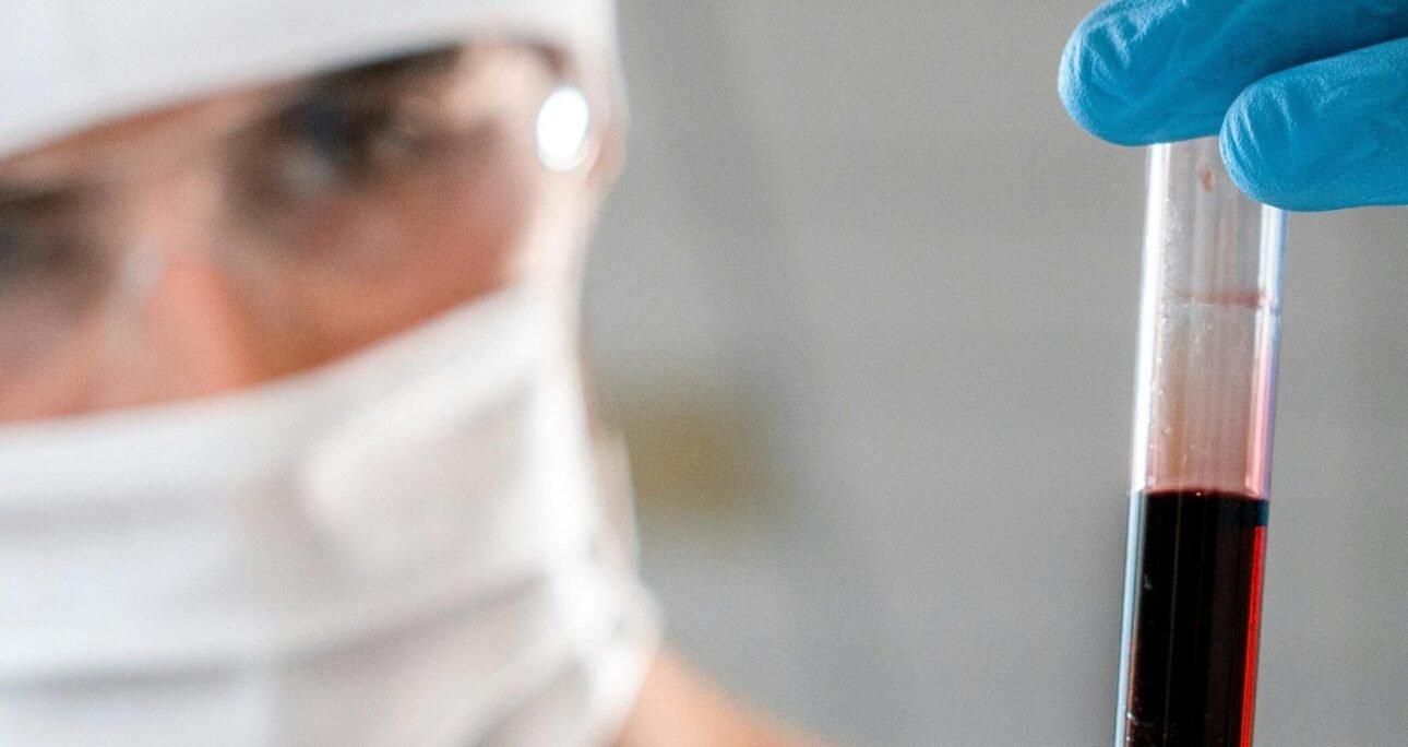 Platelet Rich Plasma